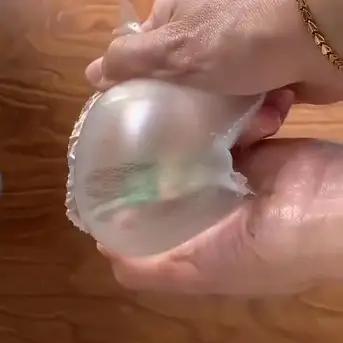 孕期妊娠纹怎么可以彻底消除,不想怀孕的时候要做好措施