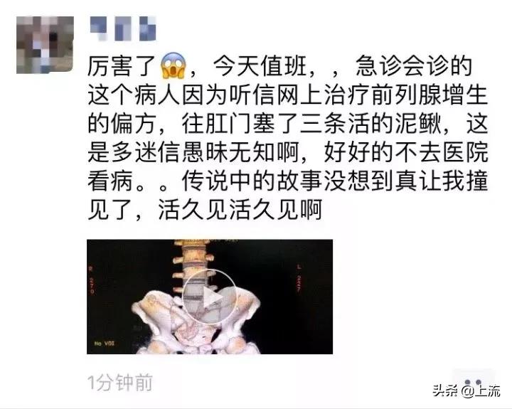 肛肠科医生的手指为什么这么粗,肛肠科医生用手指做检查
