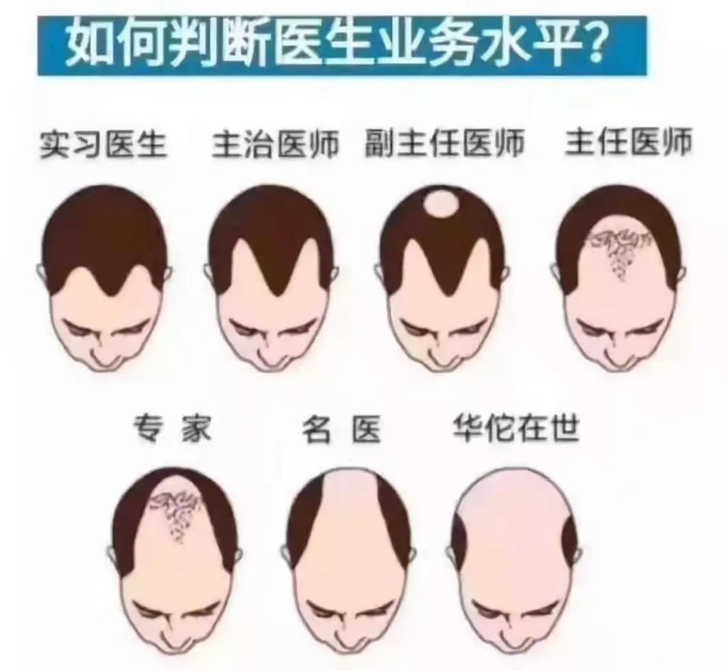 掉头发觉得很丑,掉头发怎么样看起来不像掉发