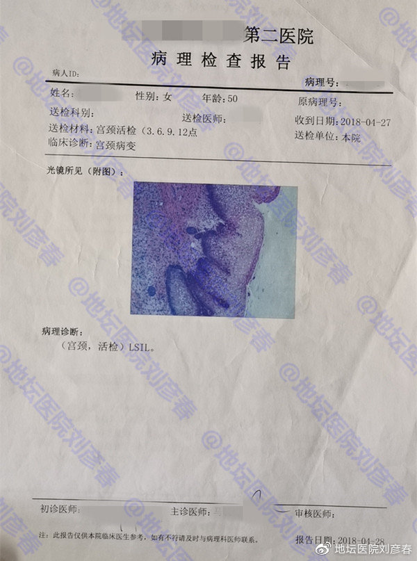 宫颈锥切术后病理还是cin3怎么办,宫颈锥切CIN2后再次病变需要几年