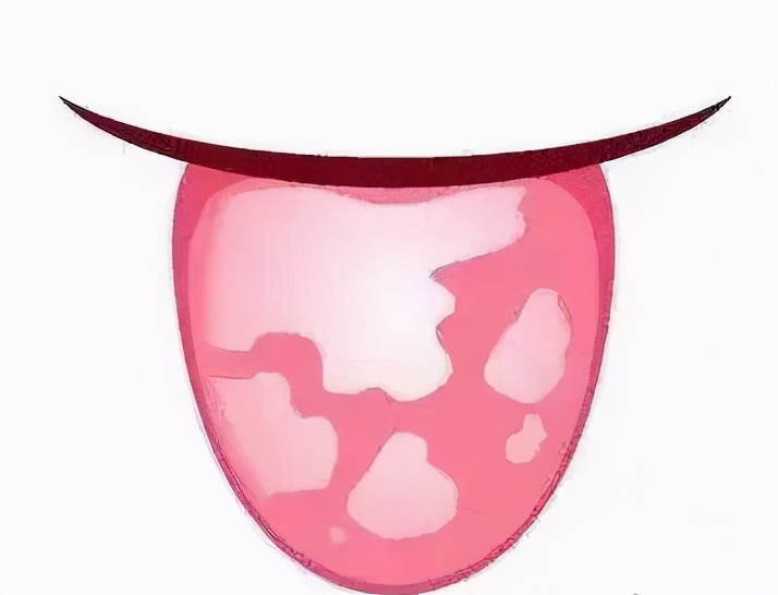 舌头异常疼痛？搞懂口腔疾病找真相