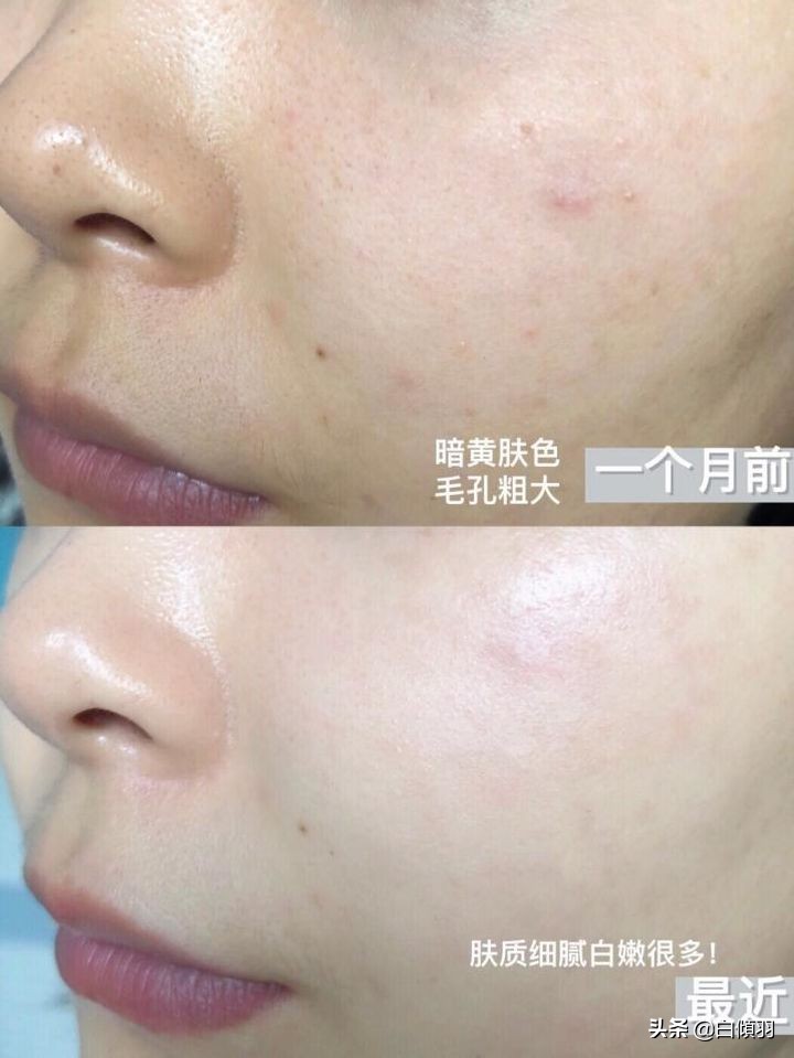 一到冬天干燥起皮,那是你角质层严重损坏了应该这样做