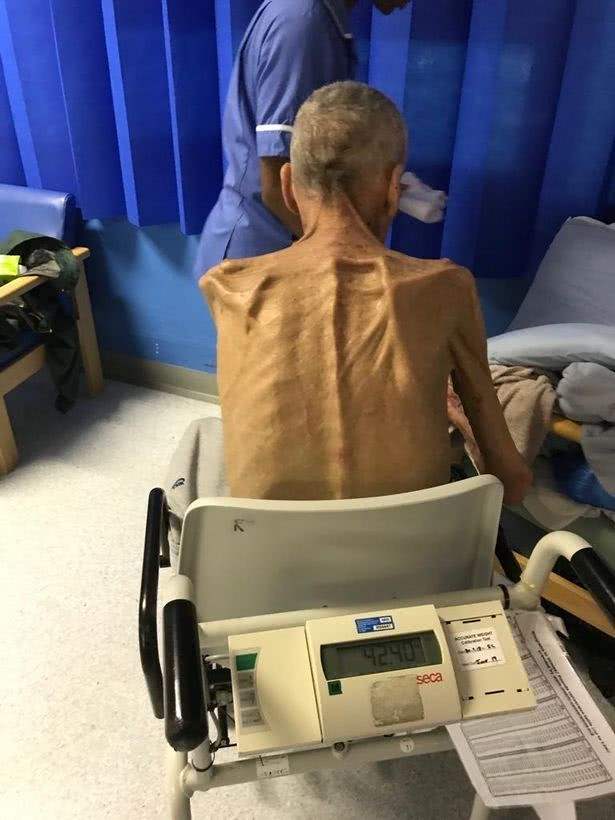 洪金宝因糖尿病而减肥,洪金宝糖尿病现状