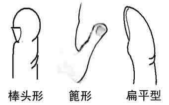 手相解析图哪个是智慧线,手相学中小拇指长短有什么区别