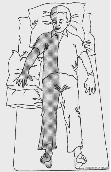 什么功法对心脑血管康复最好,心脑血管病康复治疗