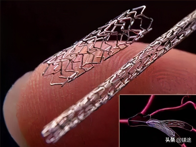 镁合金材料发展现状趋势及展望,镁的发展前景