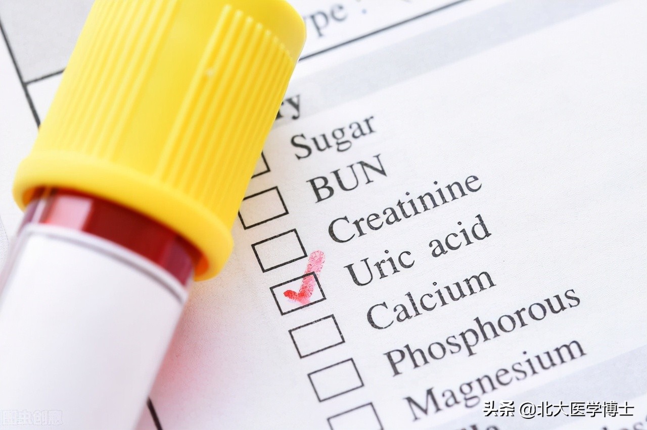 尿酸高肾排泄障碍,尿酸高碱化尿液