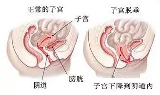 母猫产后多久身材可以恢复,产后身材多久能恢复到孕前