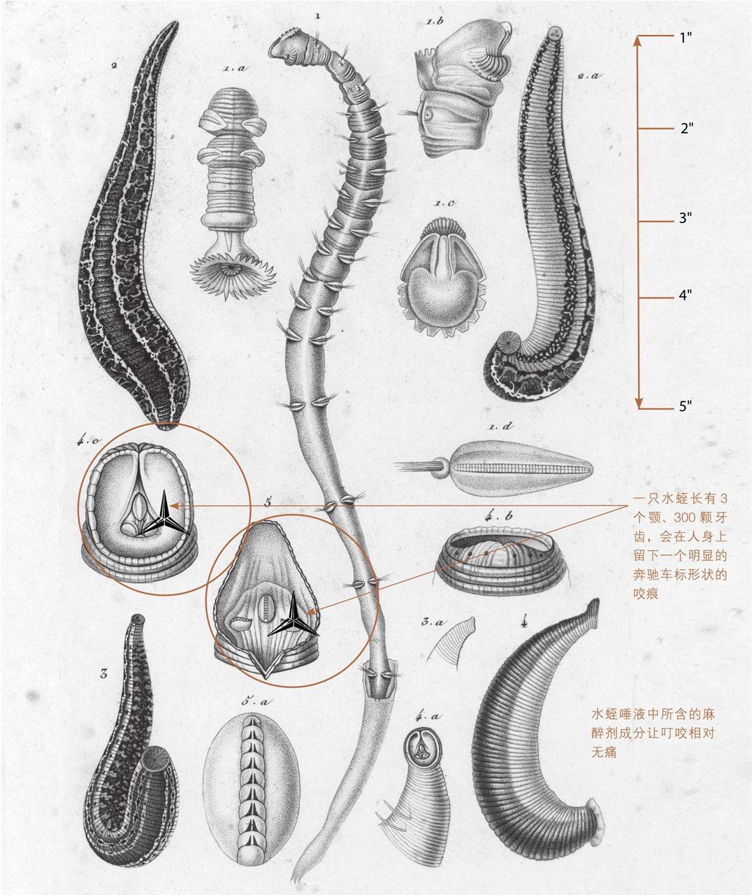 近代欧洲人曾将水蛭放入体内吸血——来治疗各种疾病