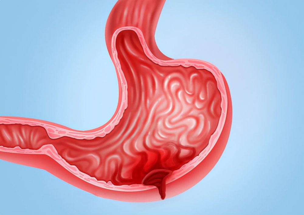 胃穿孔发病时怎么急救,胃穿孔个案护理范文