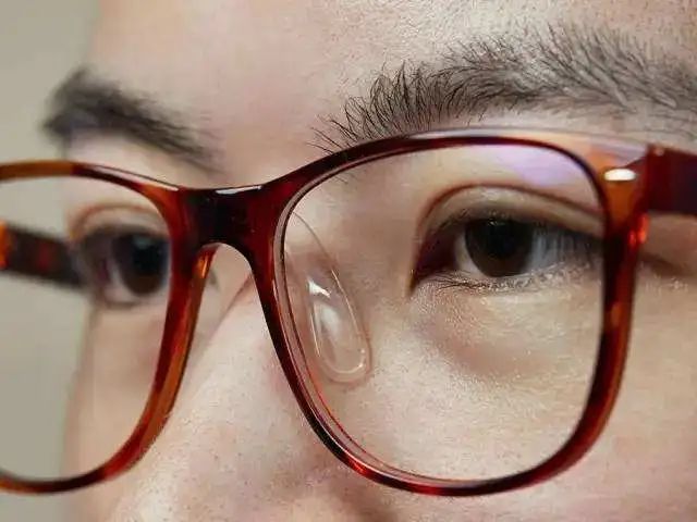 戴眼镜为什么鼻梁会凹进去,为什么戴眼镜鼻梁上有印记