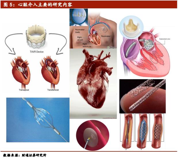 介入类医疗器械公司排名,医疗介入器械