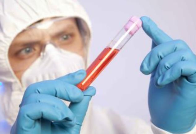 a型b型ab型o型哪种血型体质最好,a型b型ab型o型哪种血型性格较好