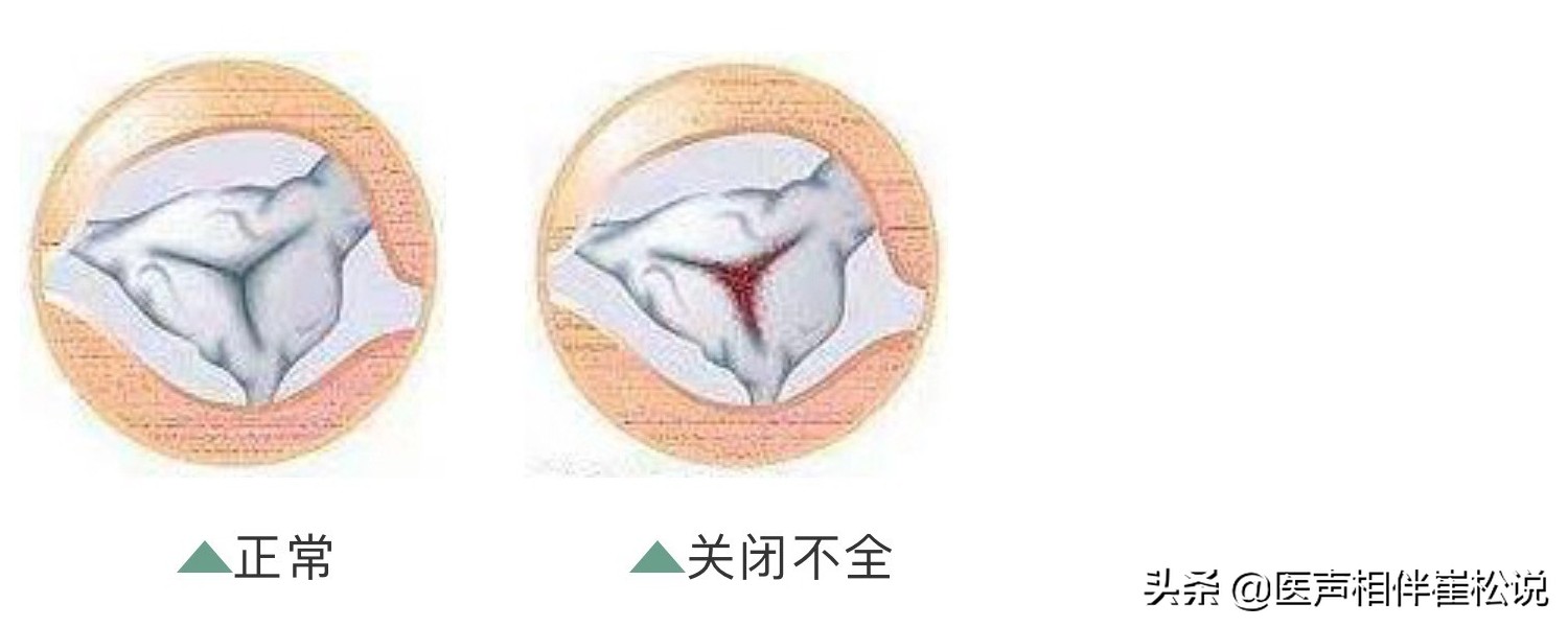 这份心脏说明书请收好,心脏保健手册