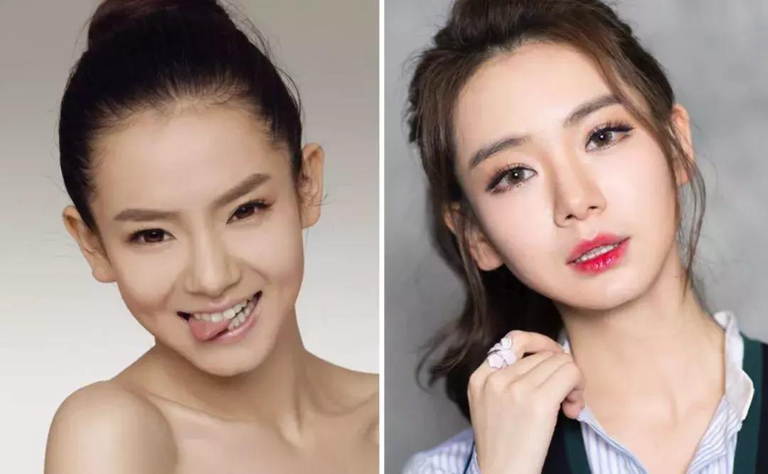 戚薇面部护肤方法,戚薇皮肤护理