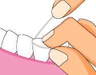 很小的牙缝会恢复吗,牙缝大了能有补救吗