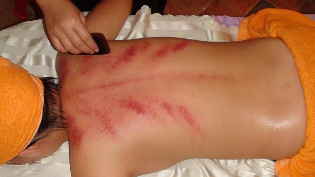 好剂师,中医刮痧师通过率高吗