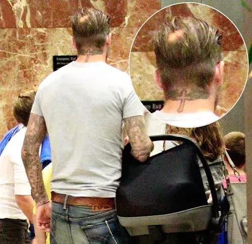 防脱的几种情况,防脱问题图