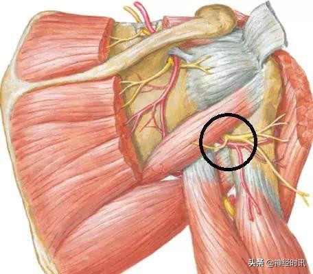 周围神经卡压解剖与分析,腓浅神经卡压解剖视频