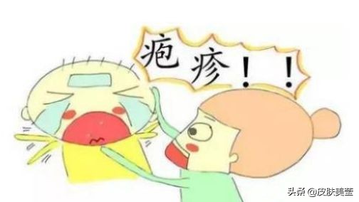 单纯疱疹病毒是什么病,单纯疱疹病毒能怀孕吗