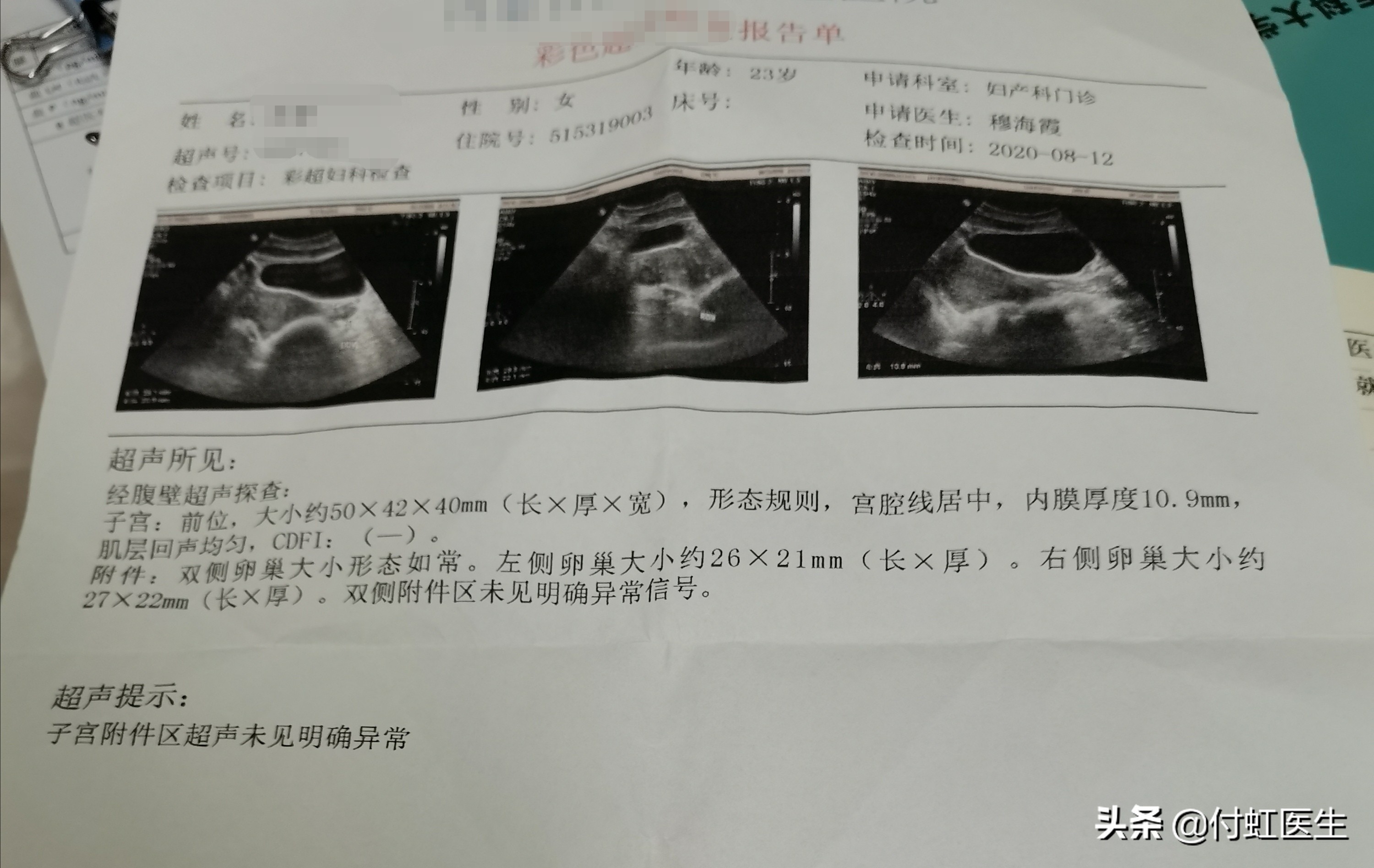 紧急避孕药后月经紊乱,吃紧急避孕药月经紊乱怎么办