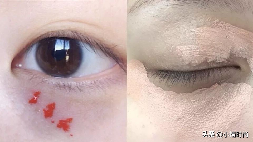 黑眼圈泪沟遮瑕手法,黑眼圈泪沟法令纹遮瑕教程来了
