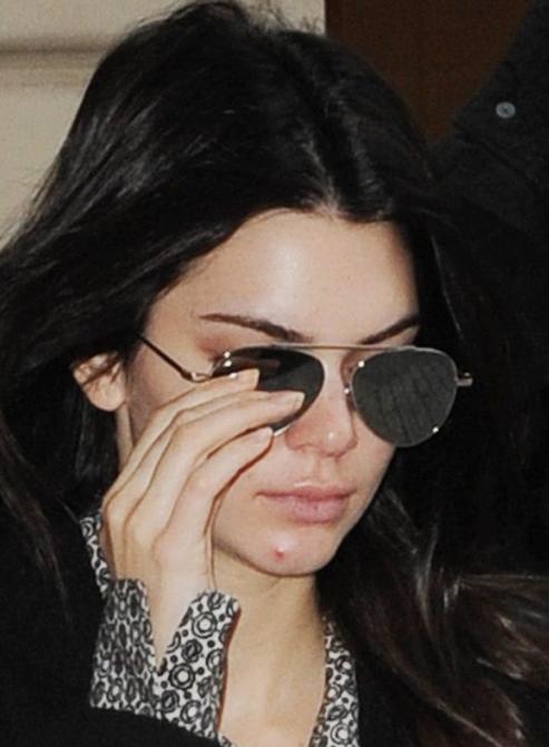 痘痘反反复复又红又疼又痒,痘痘反反复复有一层皮