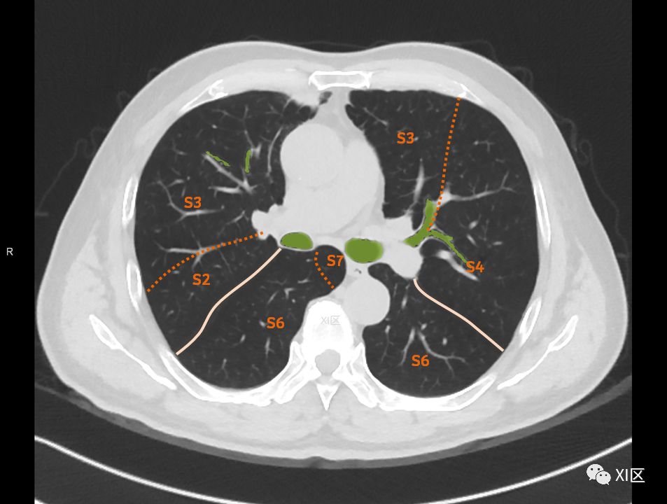 如此详细的肺部影像解剖，有点儿酷