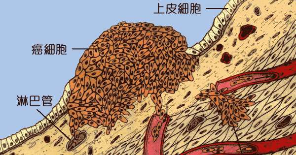 以色列发明了治愈癌症的药吗,以色列科学家肺癌治愈