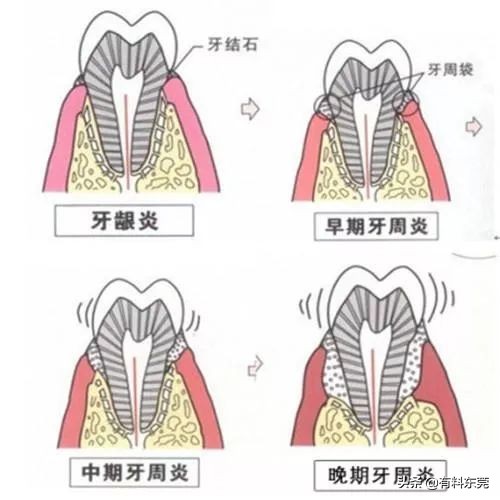 28.8元超声波洁牙！超值88折！让茶山人轻松实现...