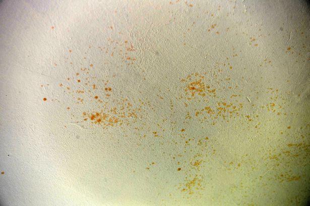 小孩误食老鼠屎会传染鼠疫吗,幼儿误食老鼠屎