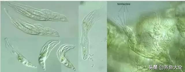 寄生虫多达6000条这种东西别乱吃,寄生虫的典型症状和表现