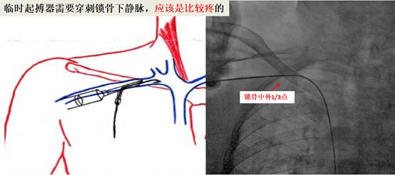 急诊手术后32岁的新妈妈对我说“医生，一点不痛，很享受”