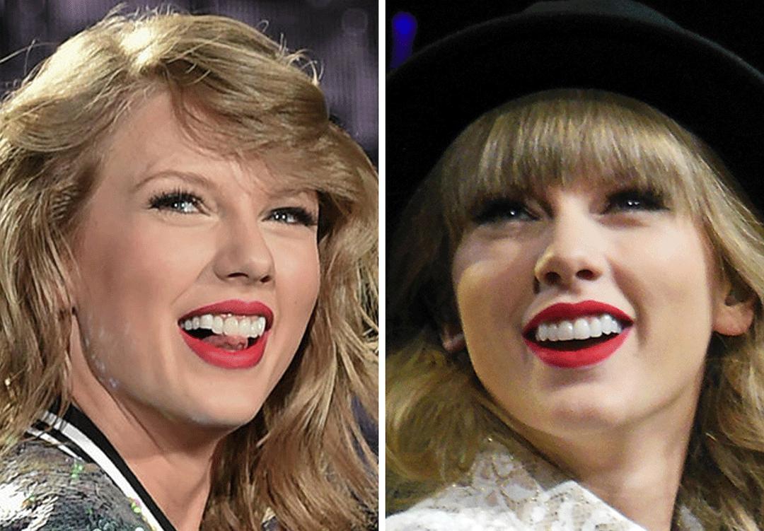 吴宣仪烤瓷牙怎么做,吴宣仪的整牙前