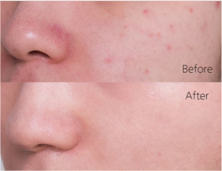 “38岁的年纪,18岁的脸”:能保持年轻的女人,手里少不了它