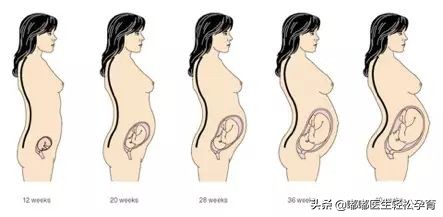 生娃后腰痛怎么快速缓解,得了月子病生二胎后怎么调理