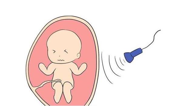 孕妇接触到x射线会怎么样,怀孕初期手机辐射有多大的影响