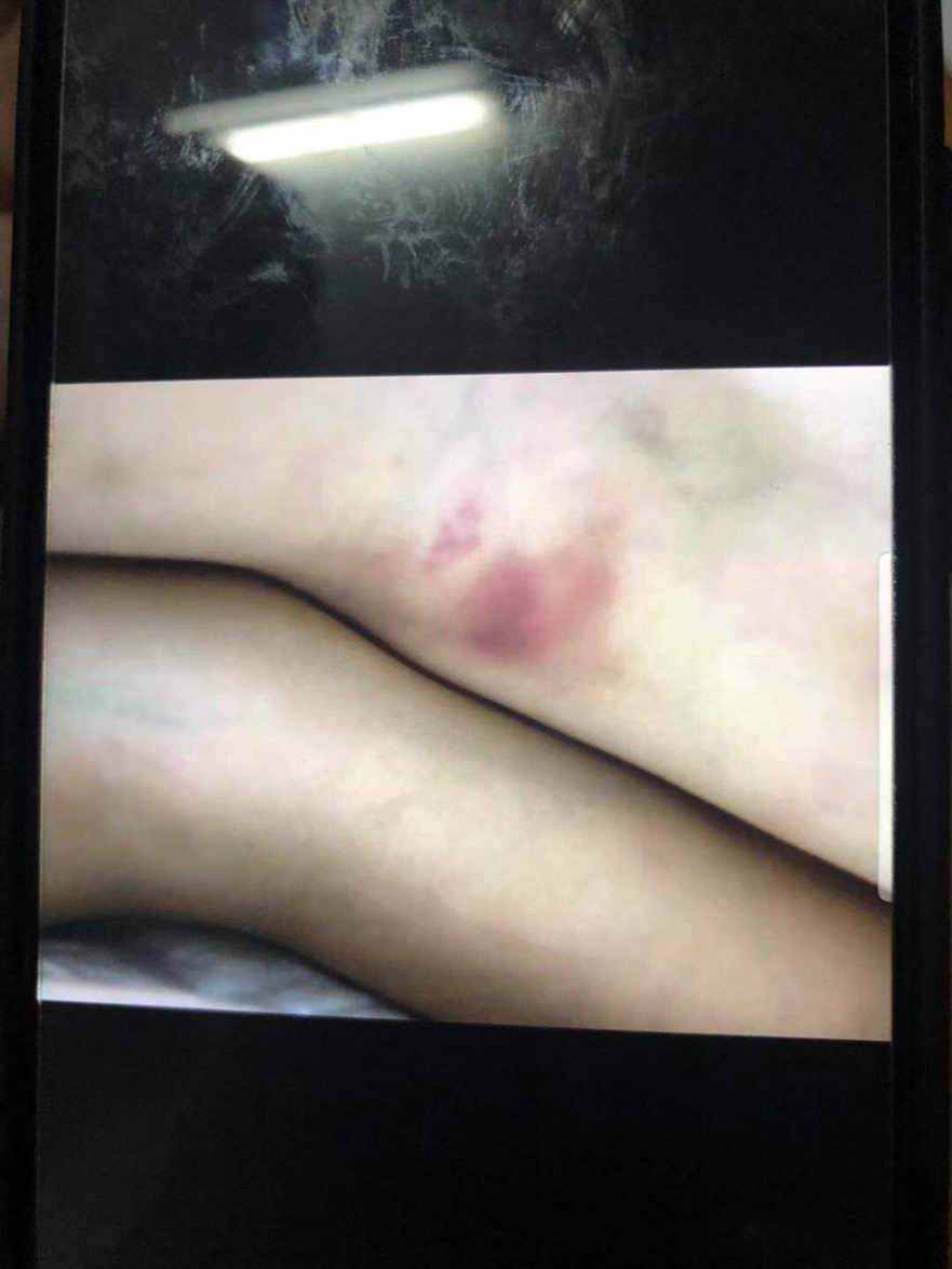 7岁男童武校身亡涉事教练被判6年,7岁小孩学武被教练打死