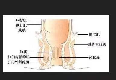 肛裂手术恢复过程中还会肛裂吗,肛裂手术需要缝合吗