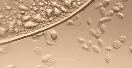 马桶顽固垢能用火烧吗,马桶陈年硬垢堵厕所