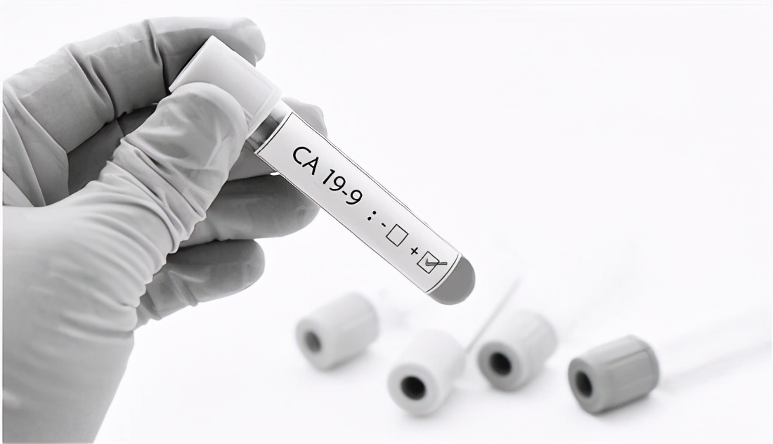 肿瘤标志物升高过于担心,体检肿瘤标志物正常能排除癌症吗