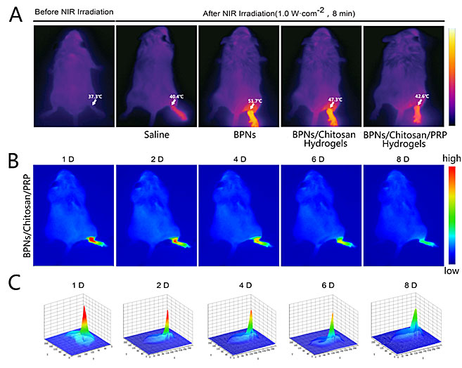 基于黑磷纳米片的多功能温敏水凝胶系统治疗类风湿