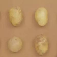 预防和改善老花眼，试试食疗加穴位