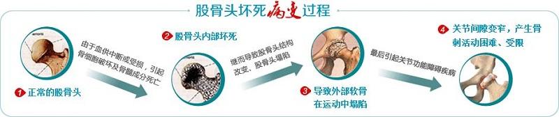 酒基因突变,酒基因