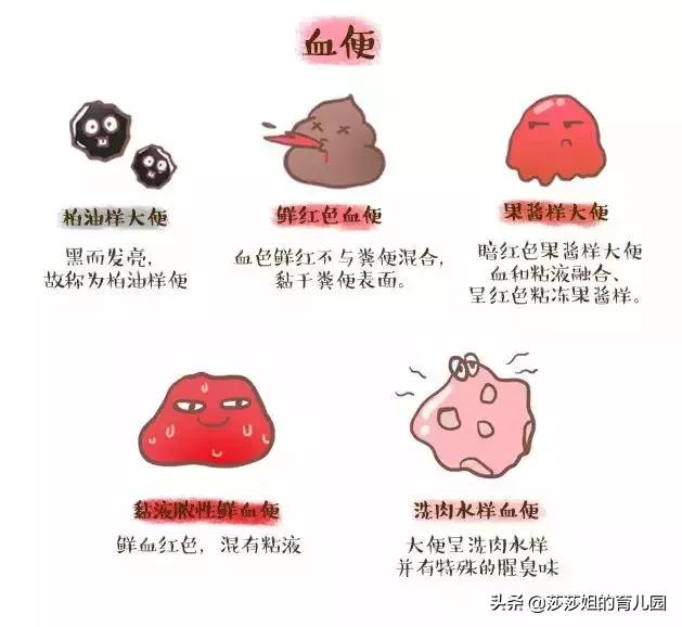 新生儿宝宝拉便便，你能看出暗藏的疾病信号吗？一看“便”知！