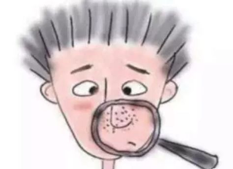 如何缩小毛孔最有效的方法,去黑头收缩毛孔最有效的方法