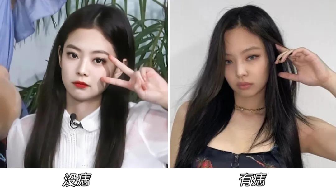 全脸点痣变美,点痣能变美吗