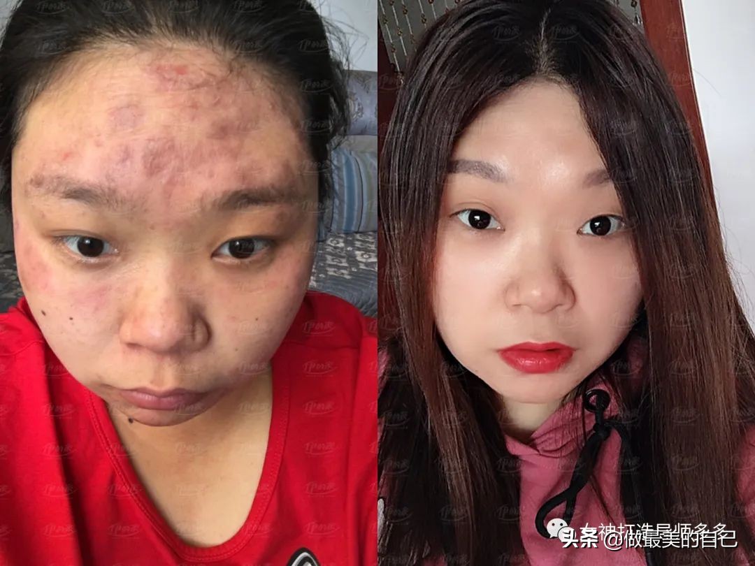 斑点暗黄肌最全的改善小技巧，都在这里