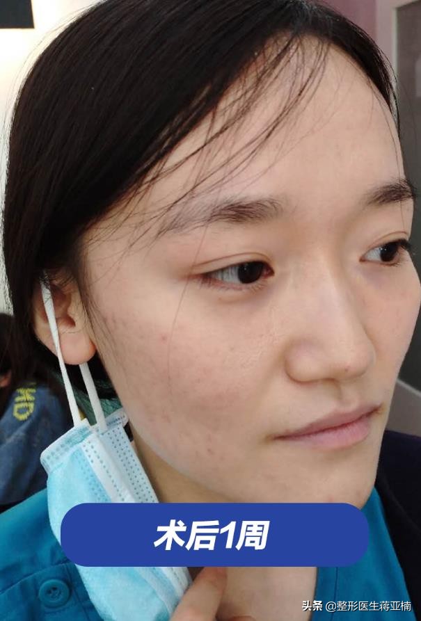 青春期如何不长痘还变美,青春不留痘原版视频