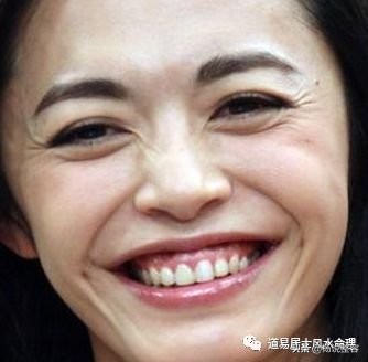 什么原因会导致法令纹越来越严重,脸上长了法令纹怎么淡化法令纹